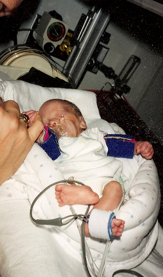 premature infant in NICU